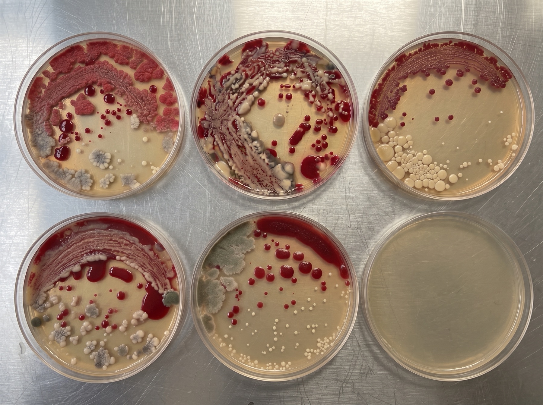 Six culture plates in a row on a white surface: one plate per cat fountain. Five are clouded with the bacteria that was living in the water; one is clean.